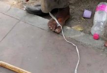 स्नायूंच्या नुकसानीपासून ते चयापचय नफ्यापर्यंत: फिटनेस आणि त्वचेचे आरोग्य पुन्हा परिभाषित करणारी नॉन-आक्रमक तंत्रज्ञान | पुणे बातम्या
