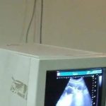 बेकायदेशीर सोनोग्राफी सेंटर चालवणाऱ्यांकडे लिंगनिश्चिती करणाऱ्या जोडप्यांचा पोलीस शोध घेणार आहेत. पुणे बातम्या