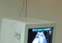 बेकायदेशीर सोनोग्राफी सेंटर चालवणाऱ्यांकडे लिंगनिश्चिती करणाऱ्या जोडप्यांचा पोलीस शोध घेणार आहेत. पुणे बातम्या